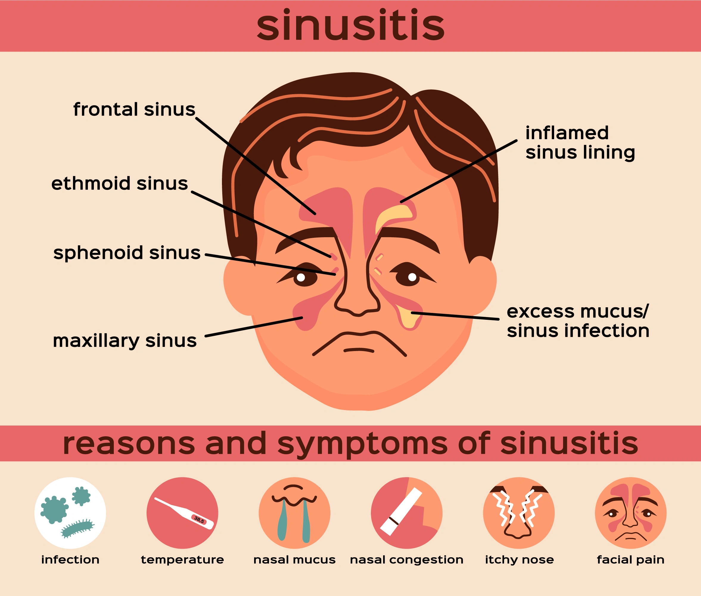 Causes_of_Sinusitis
