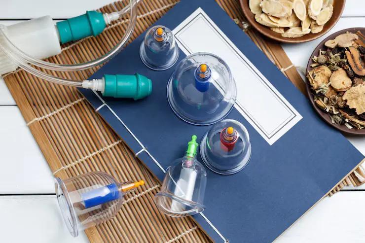 cupping-therapy-traditional-chinese-medicine