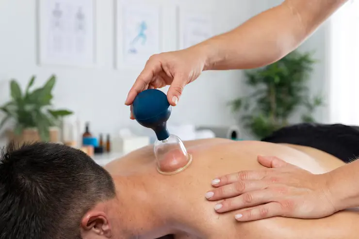 physiotherapist-performing-cupping-session-male-patient