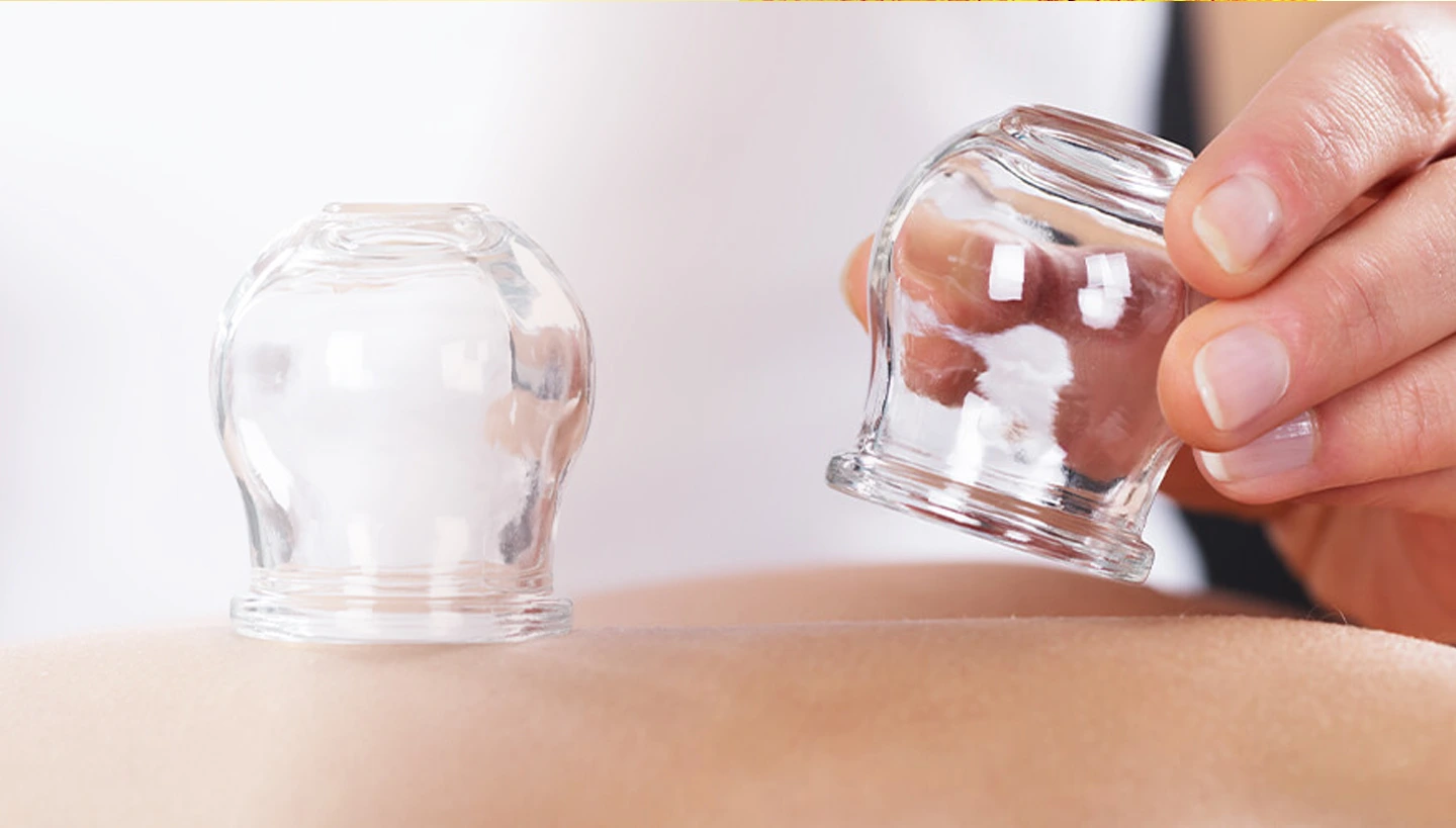 Patanjali Wellness Cupping Therapy