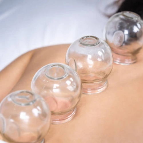 Cupping therapy equipments