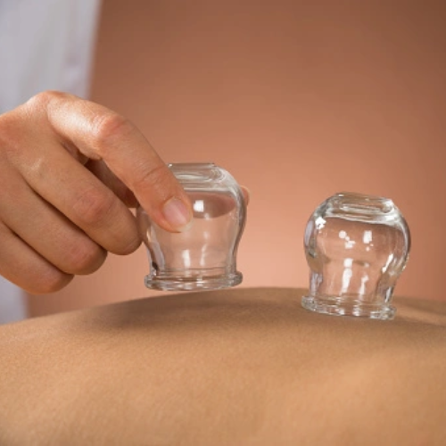 cupping therapy cups